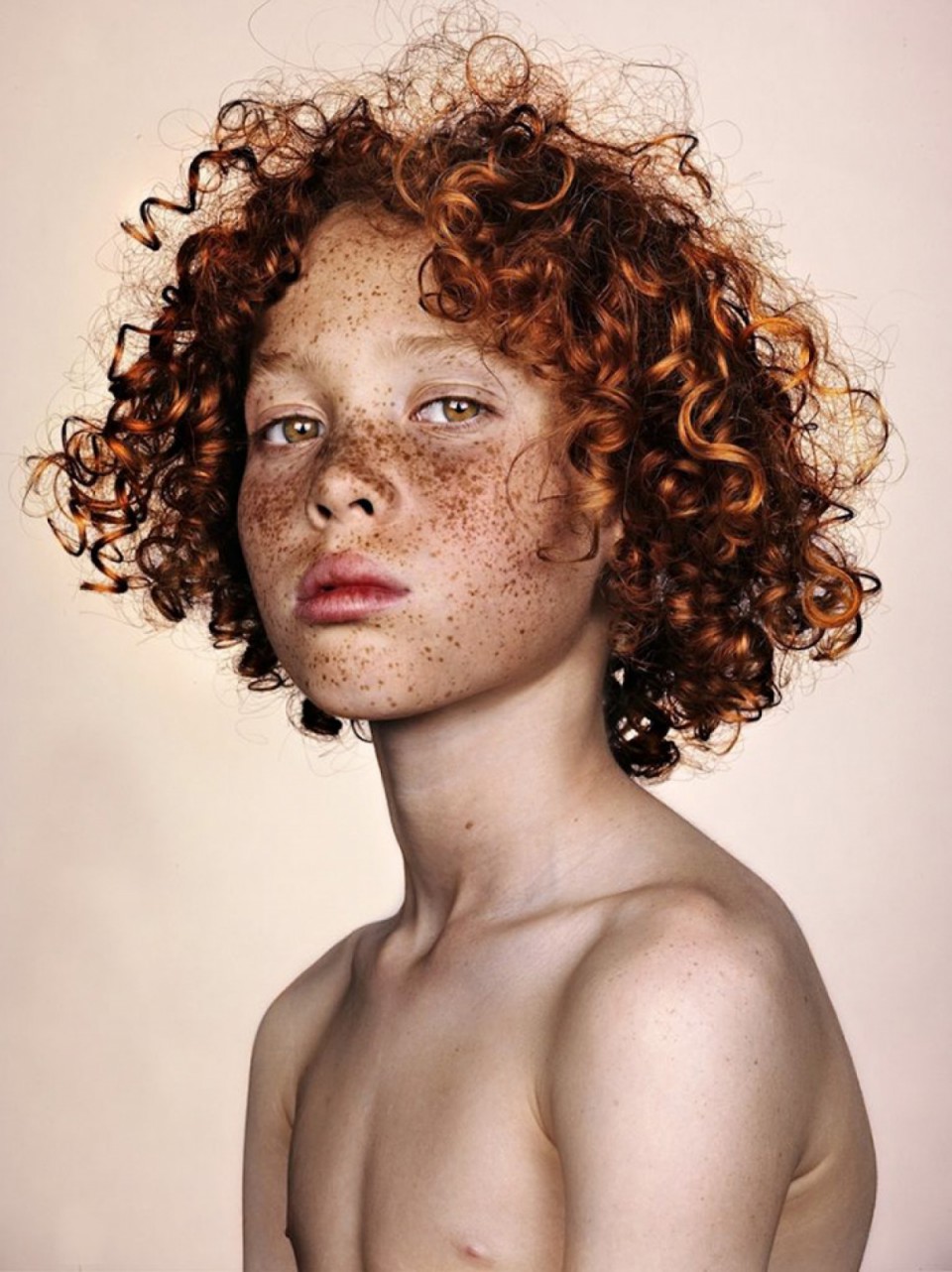 Comme se délivrer des taches de pigment sur le corps après le bronzage